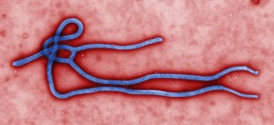 Ebola-Virus-Pictures-4